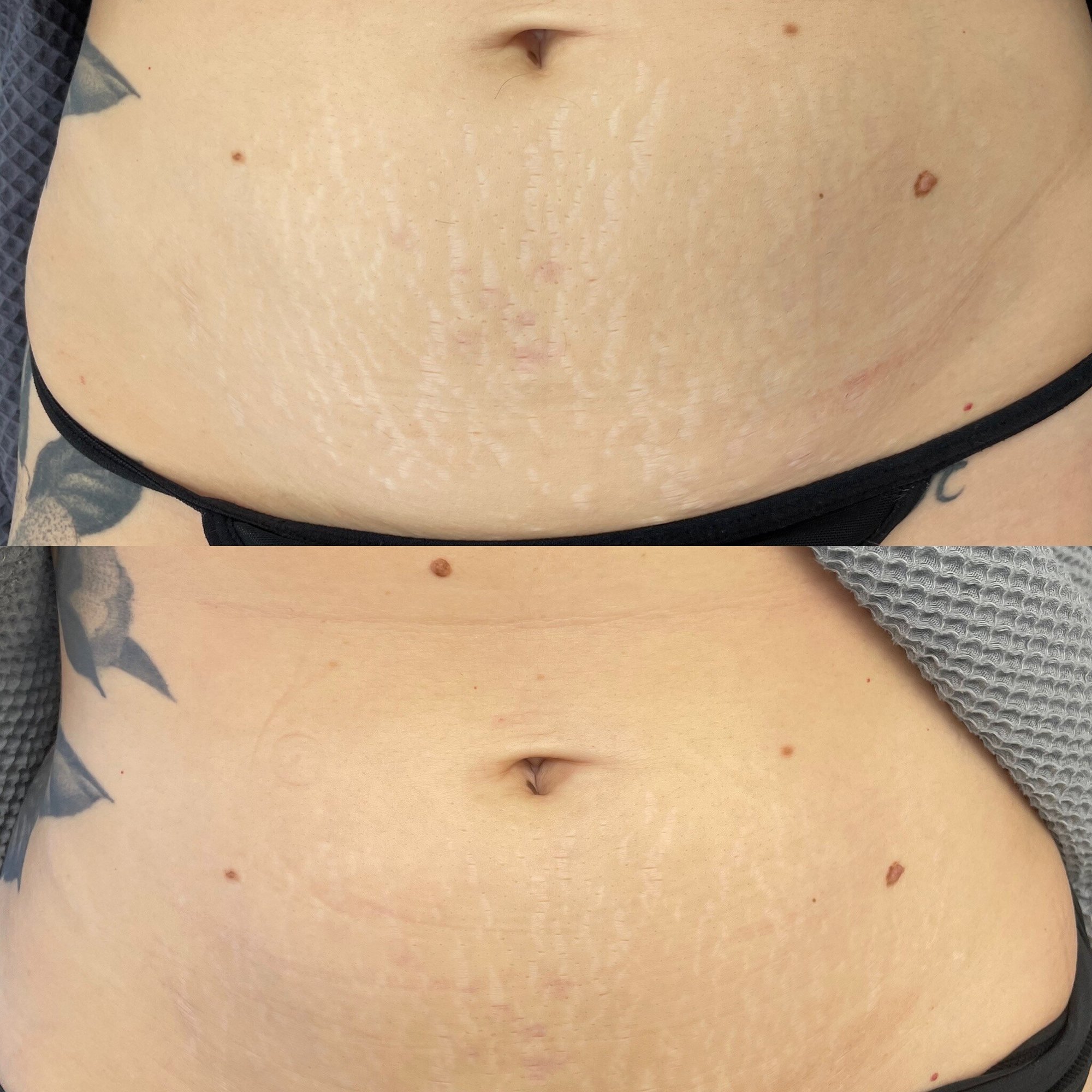 A316FD43-B7B7-45E6-A849-81CEC12F5D3C