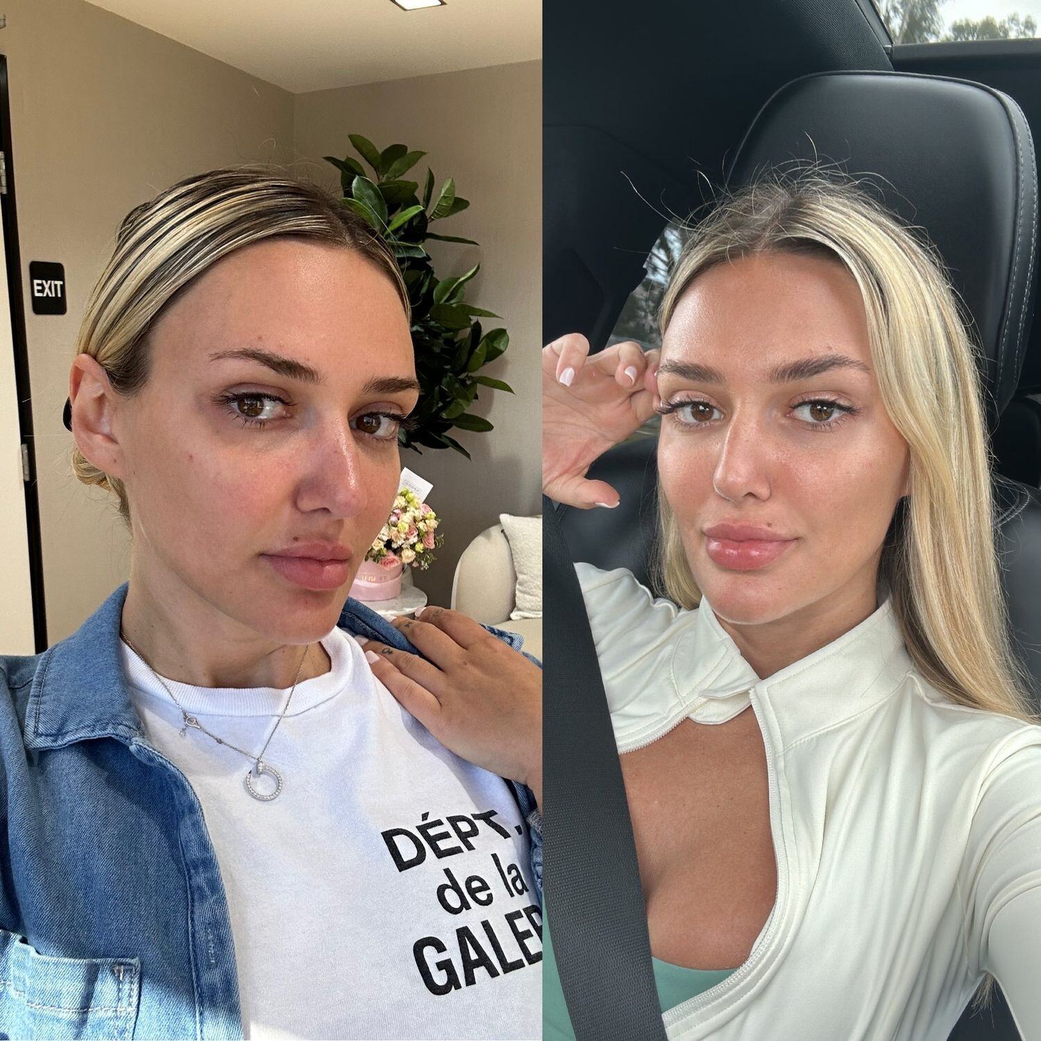 The Future of Skincare
