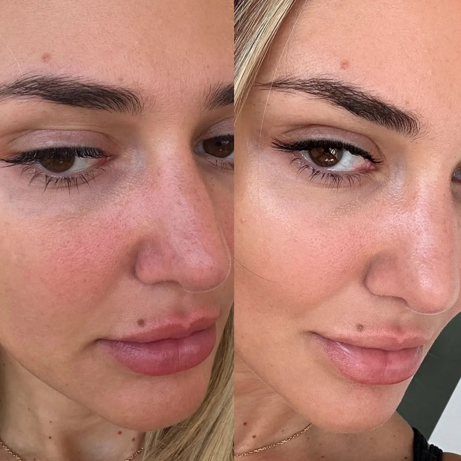 Reveal Your Radiant Skin
