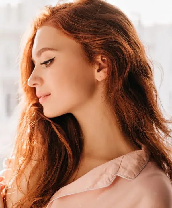 Red haired chemical peel patient model in a pink shirt