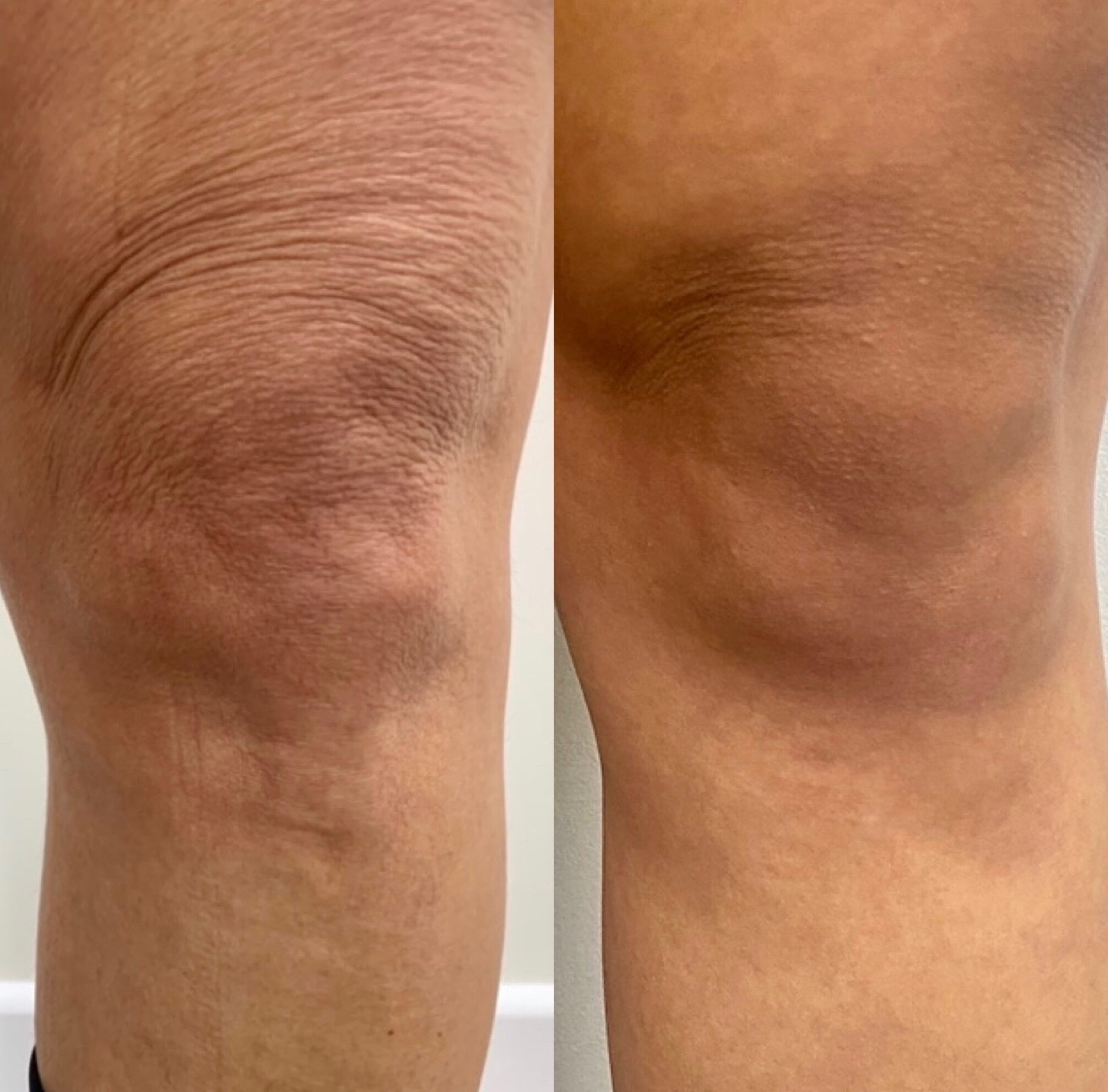 8E4A449B-DA3C-41C7-9771-0868A15497AA