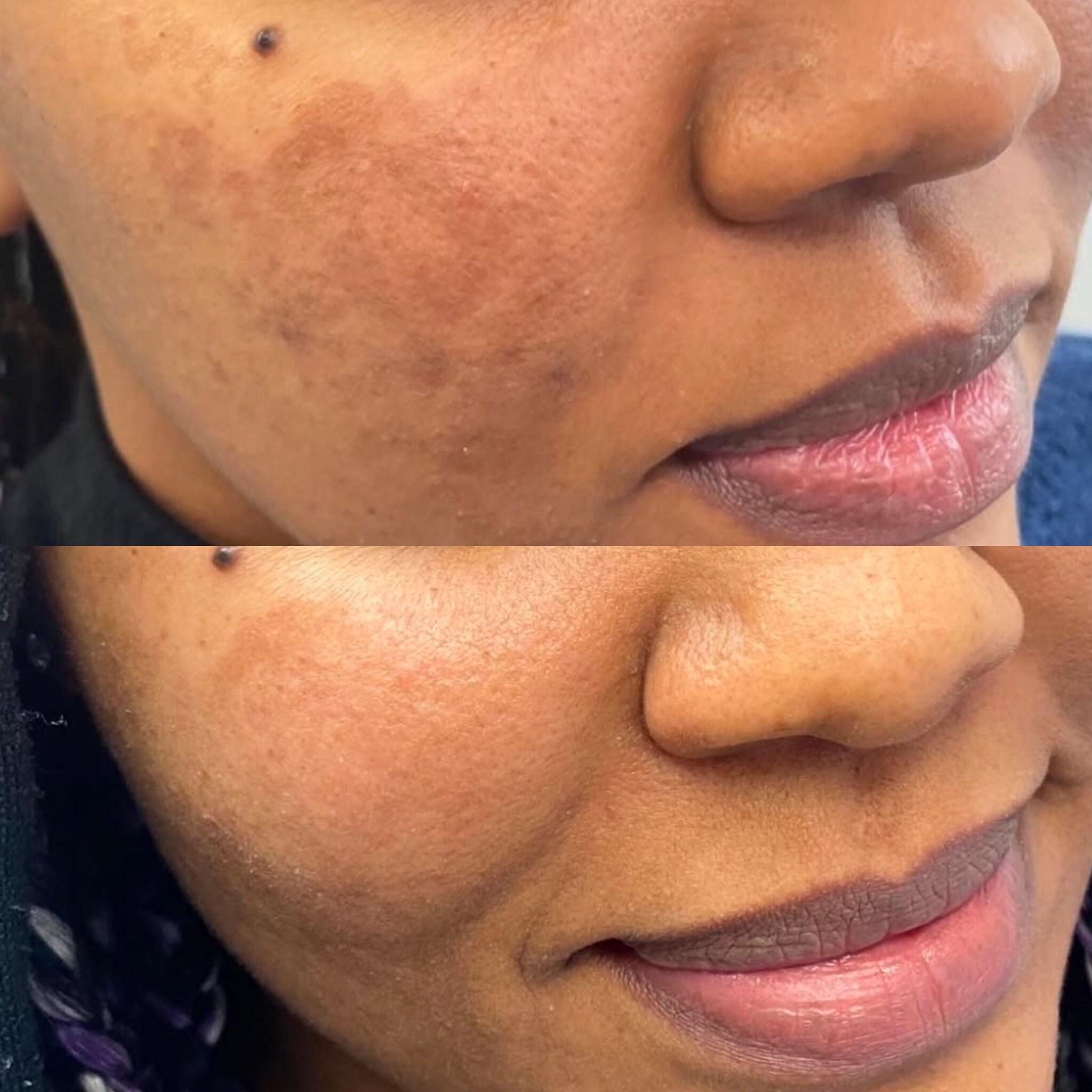 FF4CE8FE-CD9E-40B6-8493-C8023E5A0FBF